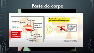 37
Parte do corpo
 
