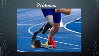 5
Próteses
 