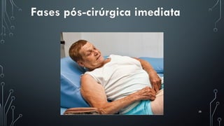 58
Fases pós-cirúrgica imediata
 