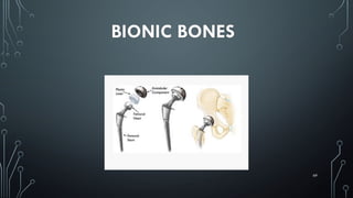 69
BIONIC BONES
 