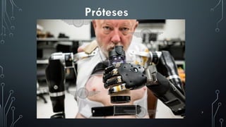 7
Próteses
 