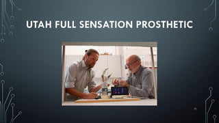 71
UTAH FULL SENSATION PROSTHETIC
 