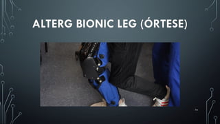 72
ALTERG BIONIC LEG (ÓRTESE)
 