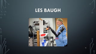 76
LES BAUGH
 