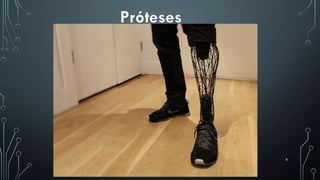 8
Próteses
 
