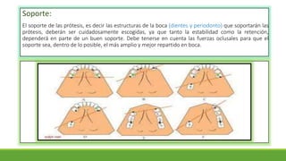 Soporte:
El soporte de las prótesis, es decir las estructuras de la boca (dientes y periodonto) que soportarán las
prótesis, deberán ser cuidadosamente escogidas, ya que tanto la estabilidad como la retención,
dependerá en parte de un buen soporte. Debe tenerse en cuenta las fuerzas oclusales para que el
soporte sea, dentro de lo posible, el más amplio y mejor repartido en boca.
 