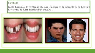 Estética:
Cando hablamos de estética dental nos referimos en la busqueda de la belleza y
naturalidad de nuestra restauración protésica .
 
