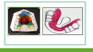 Protesis de resina para ortodoncia
 