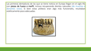 Las primeras dentaduras de las que se tiene noticia en Europa llegan en el siglo XV,
con piezas de hueso o marfil; incluso recuperando dientes naturales (de muertos o
donantes vivos). Si bien estas prótesis eran algo más funcionales, resultaban
estéticamente poco adecuadas.
 