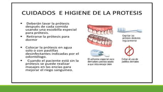 Prótesis dental
