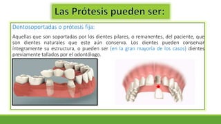 Dentosoportadas o prótesis fija:
Aquellas que son soportadas por los dientes pilares, o remanentes, del paciente, que
son dientes naturales que este aún conserva. Los dientes pueden conservar
íntegramente su estructura, o pueden ser (en la gran mayoría de los casos) dientes
previamente tallados por el odontólogo.
 