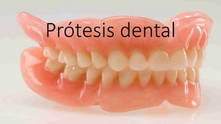 Prótesis dental
 