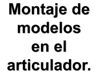 Montaje de modelos en el articulador.