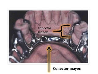 Conector menor.Conector mayor.