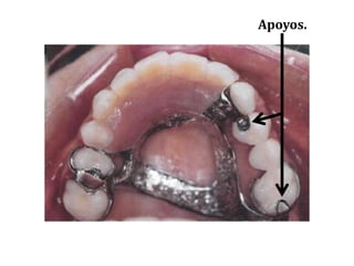 Apoyos.