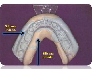 Silicona liviana.Silicona pesada.