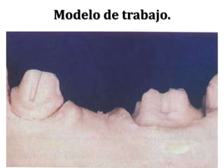Modelo de trabajo.