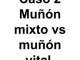 Caso 2Muñón mixto vs muñón vital.