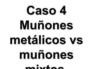 Caso 4Muñones metálicos vs muñones mixtos.