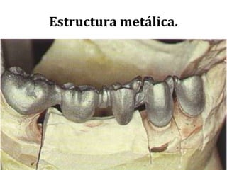 Estructura metálica.