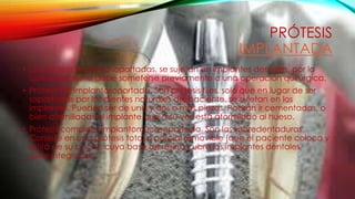 PRÓTESIS
IMPLANTADA
• Las prótesis implantosoportadas, se sujetan en implantes dentales, por lo
que el paciente debe someterse previamente a una operación quirúrgica.
• Prótesis fija implantosoportada. Son prótesis fijas, solo que en lugar de ser
soportadas por los dientes naturales del paciente, se sujetan en los
implantes. Pueden ser de una y dos o más piezas. Podrán ir cementadas, o
bien atornilladas al implante que a su vez está atornillado al hueso.
• Prótesis completa implantomucosoportada. Son las sobredentaduras.
Consiste en una prótesis total o parcial removible (que el paciente coloca y
retira de su boca), cuya base de resina cubre los implantes dentales
osteointegrados.
 