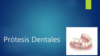 Prótesis Dentales
 