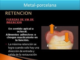 Metal-porcelana

 La máxima retención se

logra cuando solo hay una
dirección de entrada y
salida de la restauración

 