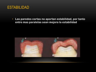 ESTABILIDAD
• Las paredes cortas no aportan estabilidad, por tanto
entre mas paralelas sean mejora la estabilidad

 