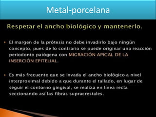 Metal-porcelana

 