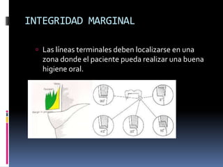 INTEGRIDAD MARGINAL
 Las líneas terminales deben localizarse en una

zona donde el paciente pueda realizar una buena
higiene oral.

 