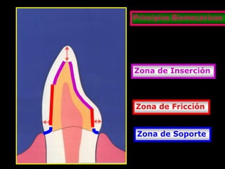 Principios Biomecanicos

Zona de Inserción

Zona de Fricción

Zona de Soporte

 