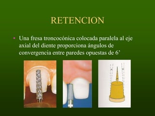 RETENCION
• Una fresa troncocónica colocada paralela al eje
axial del diente proporciona ángulos de
convergencia entre paredes opuestas de 6’

 