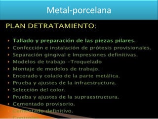 Metal-porcelana

 