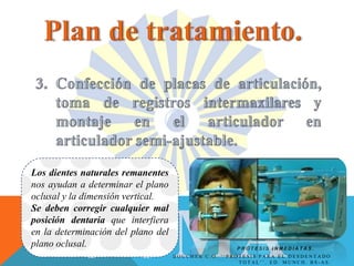 P R Ó T E S I S I N M E D I A T A S .
Los dientes naturales remanentes
nos ayudan a determinar el plano
oclusal y la dimensión vertical.
Se deben corregir cualquier mal
posición dentaria que interfiera
en la determinación del plano del
plano oclusal.
B O U C H E R C . O . ‘ ‘ P R Ó T E S I S P A R A E L D E S D E N T A D O
T O T A L ’ ’ . E D . M U N C H . B S - A S .
 