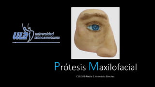 Prótesis Maxilofacial
C.D.E.P.B Nadia E. Arámbula Sánchez
 