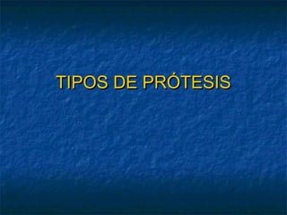TIPOS DE PRÓTESIS

 