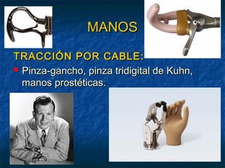 MANOS
TRACCIÓN POR CABLE:
 Pinza-gancho, pinza tridigital de Kuhn,
manos prostéticas.

 