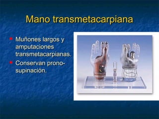 Mano transmetacarpiana




Muñones largos y
amputaciones
transmetacarpianas.
Conservan pronosupinación.

 