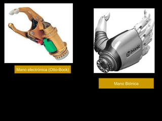 Mano electrónica (Otto-Bock)
Mano Biónica

 