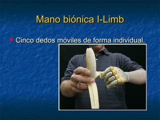 Mano biónica I-Limb


Cinco dedos móviles de forma individual.

 