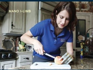 MANO I-LIMB

 