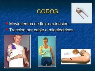 CODOS



Movimientos de flexo-extensión.
Tracción por cable o mioeléctricos.

 