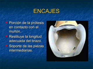 ENCAJES






Porción de la prótesis
en contacto con el
muñón.
Restituye la longitud
adecuada del brazo.
Soporte de las piezas
intermediarias.

 