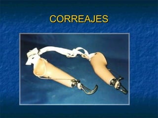 CORREAJES

 