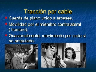 Tracción por cable






Cuerda de piano unido a arneses.
Movilidad por el miembro contralateral
( hombro).
Ocasionalmente, movimiento por codo si
no amputado.

 