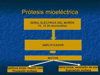 Prótesis mioeléctrica
SEÑALSEÑAL ELÉCTRICA DEL MUÑÓN
ELÉCTRICA DEL MUÑÓN
10, 15 20 microvoltios

AMPLIFICADOR

MOTOR

Apertura pinza, flexión codo
Pronación muñeca.

Cierre pinza, extensión de codo
Supinación muñeca

 