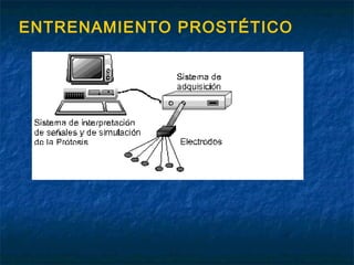 ENTRENAMIENTO PROSTÉTICO

 