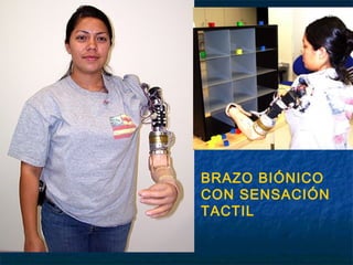 BRAZO BIÓNICO
CON SENSACIÓN
TACTIL

 