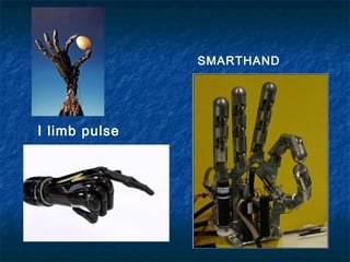 SMARTHAND

I limb pulse

 