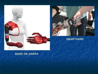 SMARTHAND

MANO DE DARPA

 